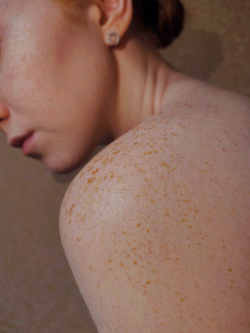 Your Skin Type & What It Needs